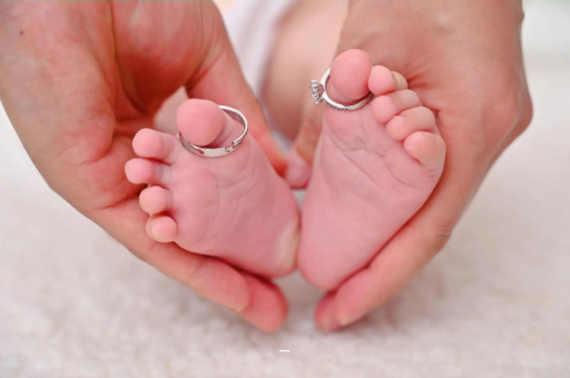 长宁孕妇怎样预防妊娠纹 长宁孕妇怎样预防妊娠纹